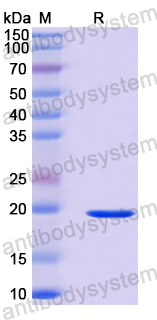 Recombinant Human DDHD2 Protein, N-His