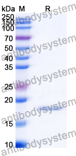 Recombinant Human SORBS2 Protein, N-His