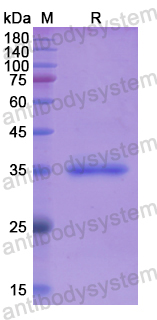 Recombinant Human ERLIN2 Protein, N-His