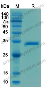 Recombinant Human DKK1 Protein, N-His