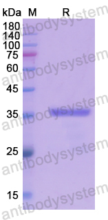 Recombinant Human CDK14 Protein, N-His