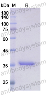 Recombinant Human GLS Protein, N-His