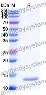 Recombinant Human USP19 Protein, N-His