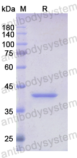 Recombinant Human CCNB2 Protein, N-His