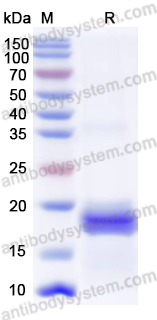 Recombinant Human KCNK2 Protein, N-His