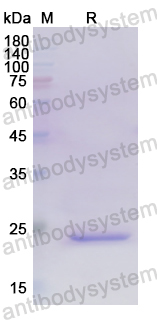 Recombinant Human TNFSF15 Protein, N-His