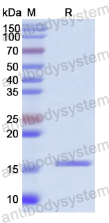 Recombinant Human GABARAP Protein, N-His