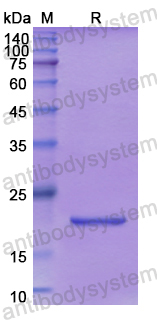 Recombinant Human SCEL Protein, N-His