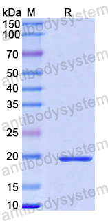 Recombinant Human CSPG5 Protein, N-His-SUMO