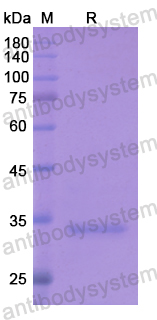 Recombinant Human ZWINT Protein, N-His