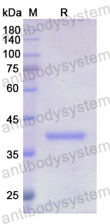 Recombinant Human CD218b/IL18RAP Protein, N-His