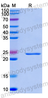 Recombinant Human TRIM16 Protein, N-His