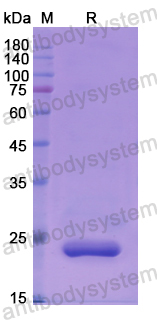 Recombinant Human LYPLA2 Protein, N-His