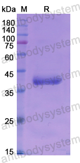 Recombinant Human BMP10 Protein, N-GST