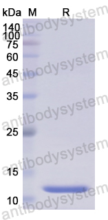 Recombinant Human UTS2 Protein, N-His