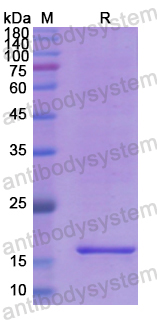 Recombinant Human SVIL Protein, N-His