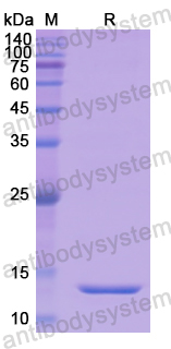 Recombinant Human SLC34A2/NaPi2b Protein, N-His