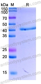 Recombinant Human SLC34A2/NaPi2b Protein, N-GST