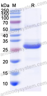 Recombinant Human SLC34A2/NaPi2b Protein, N-His-SUMO