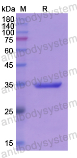 Recombinant Human PARN Protein, N-GST