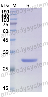 Recombinant Human SGPL1 Protein, N-His