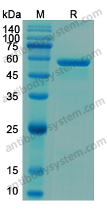 Recombinant Human H6PD Protein, N-His