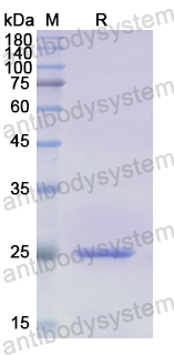 Recombinant Human VNN1 Protein, N-His