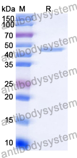 Recombinant Human CBX6 Protein, N-Strep