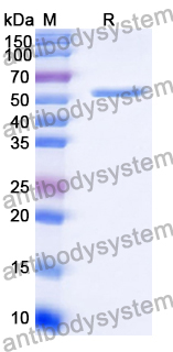 Recombinant Human YEATS4 Protein, N-GST