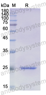 Recombinant Human ADCY5 Protein, N-His