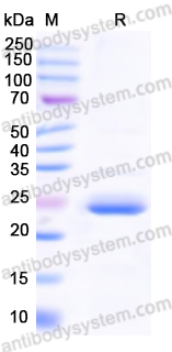 Recombinant Human ADCY5 Protein, N-His