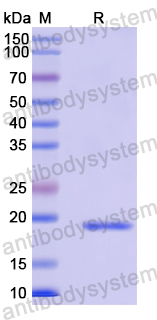 Recombinant Human CDS2 Protein, N-His-SUMO