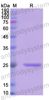 Recombinant Human FGF19 Protein, N-His