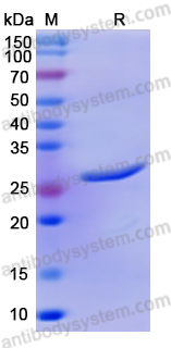 Recombinant Human DDX58 Protein, N-His