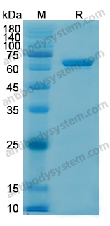 Recombinant Human AIFM1/AIF Protein, N-His