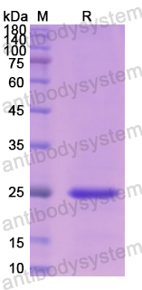 Recombinant Human CLDN1 Protein, N-His