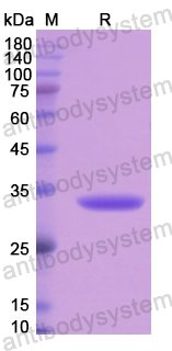 Recombinant Human EML2 Protein, N-His