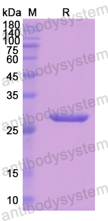 Recombinant Human ANGPTL1 Protein, N-His