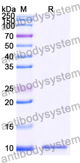 Recombinant Human TSPAN13 Protein, C-His