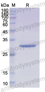 Recombinant Human SNAI1 Protein, N-His