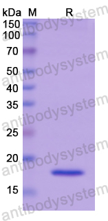 Recombinant Human FADS2 Protein, N-His