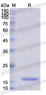 Recombinant Human DDAH2 Protein, N-His