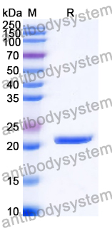 Recombinant Human LY6G6D/MEGT1 Protein, N-His-SUMO