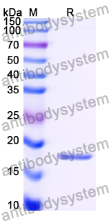 Recombinant Human TXNDC12 Protein, N-His