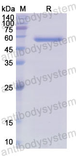 Recombinant Human ITGBL1 Protein, C-His