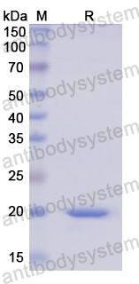 Recombinant Human AGR2/HPC8 Protein, N-His