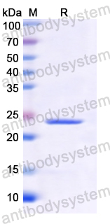 Recombinant Human PTTG1 Protein, N-His