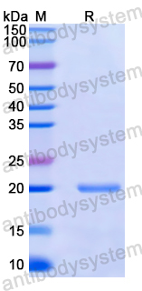 Recombinant Human PTTG1 Protein, N-His-SUMO