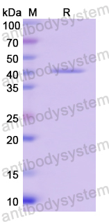 Recombinant Human TOMM40 Protein, N-His