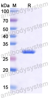 Recombinant Human PAK4 Protein, N-His